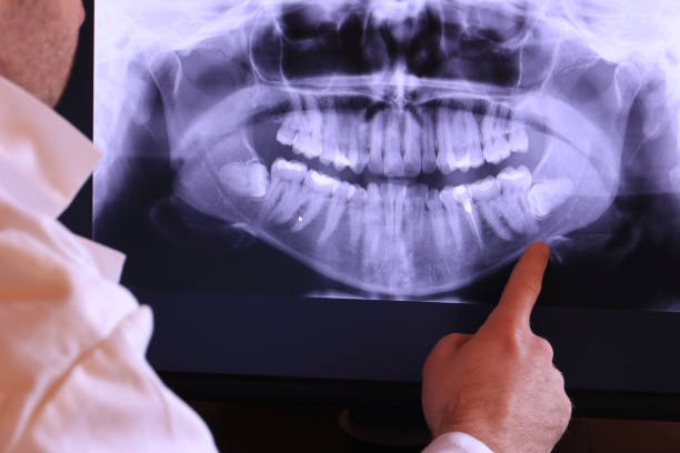 Best Emergency Care for Gum Disease in Harbor Springs, MI